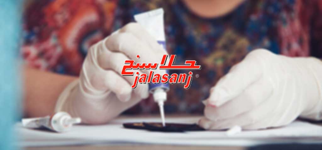 جلاسنج - لیست قیمت محصولات چسب جلاسنج